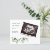 Eukalyptus Sonogram Pregnancy Ankündigung (Stehend Vorderseite)