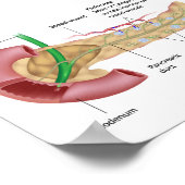 Exocrin und endokrine Bauchspeicheldrüse, gezeichn Poster (Ecke)