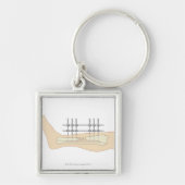 Externes Fixator Schlüsselanhänger (Vorne)