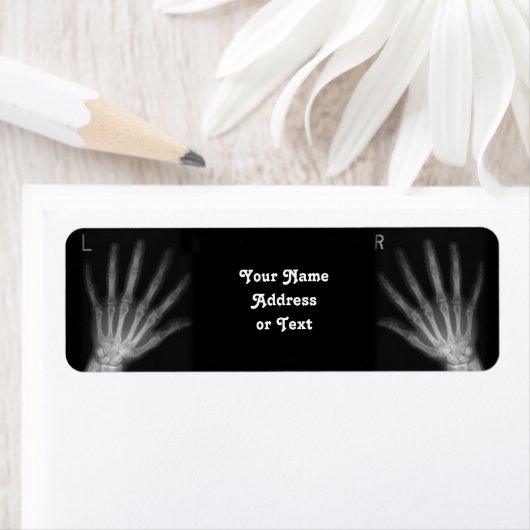 Extra-Digit-Röntgen-rechte und Links Hände (Insitu)