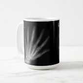 Extra-Digit-Röntgen-rechte und Links Hände Kaffeetasse (Vorderseite Links)