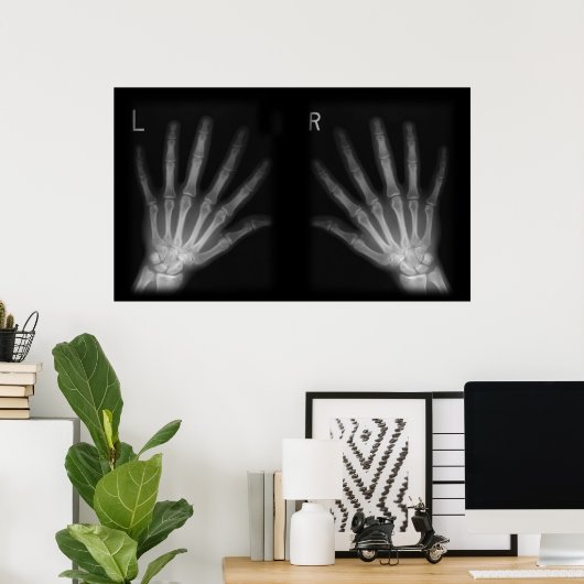 Extra-Digit-Röntgen-rechte und Links Hände Poster (Heimbüro)