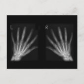 Extra-Digit-Röntgen-rechte und Links Hände Postkarte (Vorderseite)