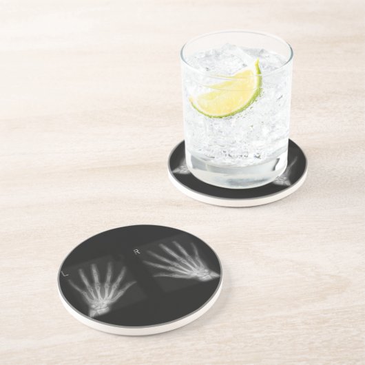 Extra-Digit-Röntgen-rechte und Links Hände Sandstein Untersetzer (Seite)