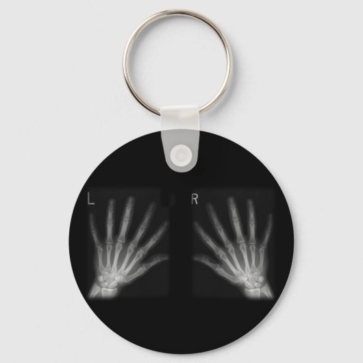 Extra-Digit-Röntgen-rechte und Links Hände Schlüsselanhänger (Vorderseite)