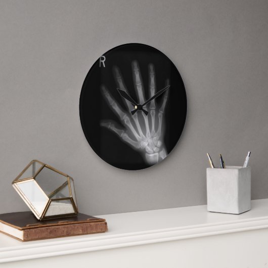Extra-Digit Röntgenbild rechte Hand Große Wanduhr (Büro)