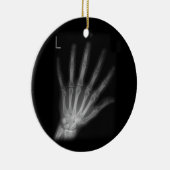 Extra Digit X-ray Left Hand Keramik Ornament (Rechts)