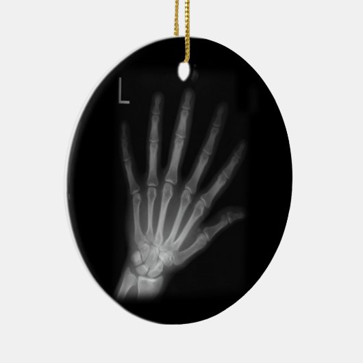 Extra Digit X-ray Left Hand Keramik Ornament (Rechts)