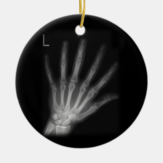 Extra Digit X-ray Left Hand Keramik Ornament (Vorne)