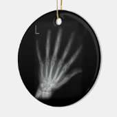 Extra Digit X-ray Left Hand Keramik Ornament (Links)