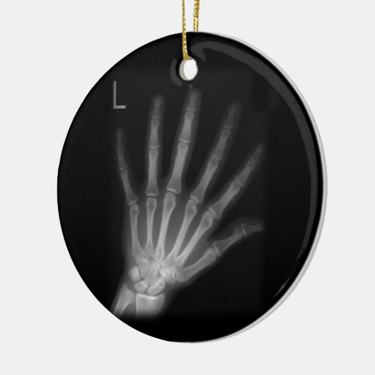Extra Digit X-ray Left Hand Keramik Ornament (Links)