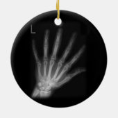 Extra Digit X-ray Left Hand Keramik Ornament (Hinten)