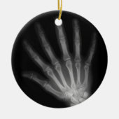 Extra Digit X-ray Left Hand Keramikornament (Vorne)