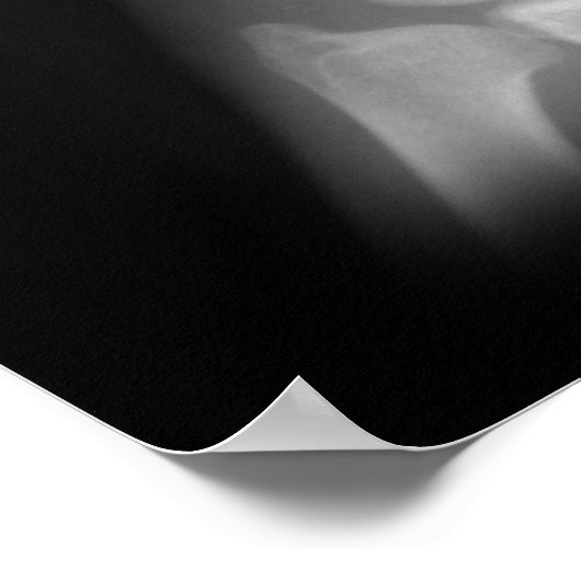 Extra Digit X-ray Left Hand Poster (Ecke)