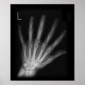 Extra Digit X-ray Left Hand Poster (Vorne)