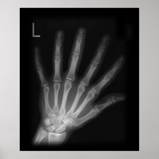 Extra Digit X-ray Left Hand Poster (Vorne)