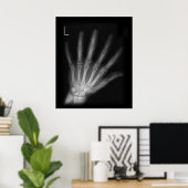 Extra Digit X-ray Left Hand Poster (Heimbüro)