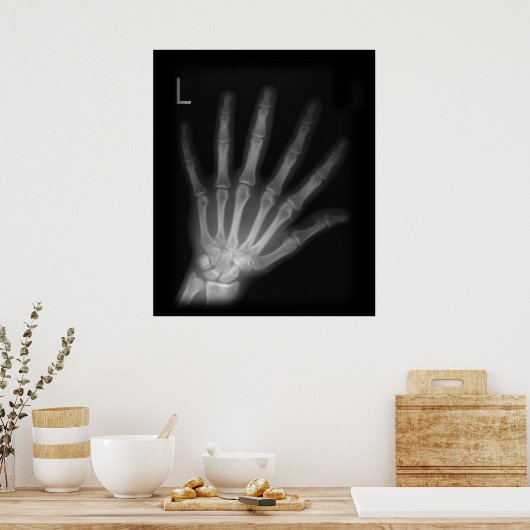 Extra Digit X-ray Left Hand Poster (Küche)