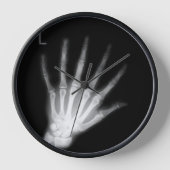Extra Digit X-ray Left Hand Uhr (Vorderseite)