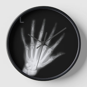 Extra Digit X-ray Left Hand Uhr