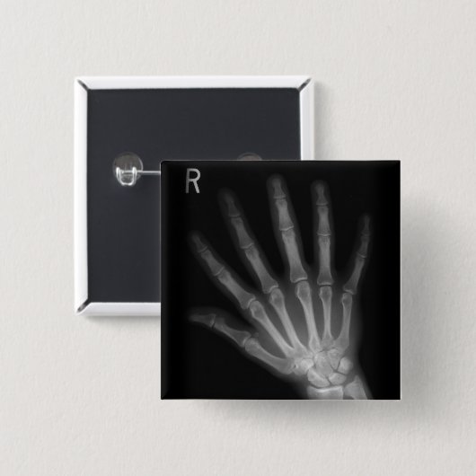 Extra Digit X-ray Right Hand Button (Vorne & Hinten)