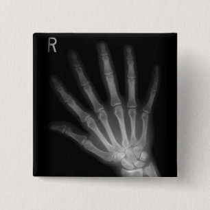 Extra Digit X-ray Right Hand Button
