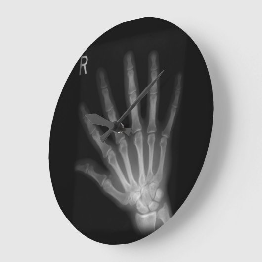 Extra Digit X-ray Right Hand Große Wanduhr (Winkel)