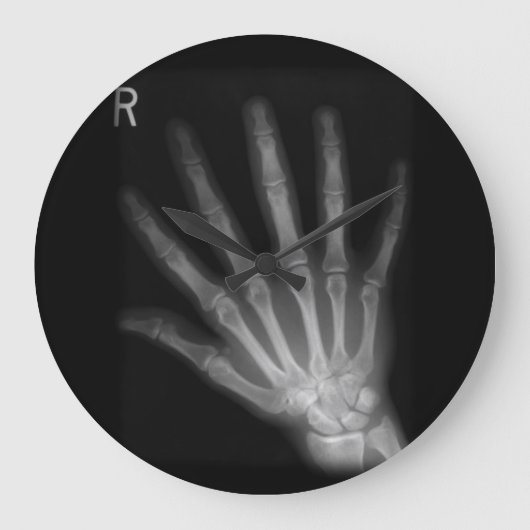 Extra Digit X-ray Right Hand Große Wanduhr (Vorderseite)