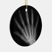 Extra Digit X-ray Right Hand Keramikornament (Rechts)