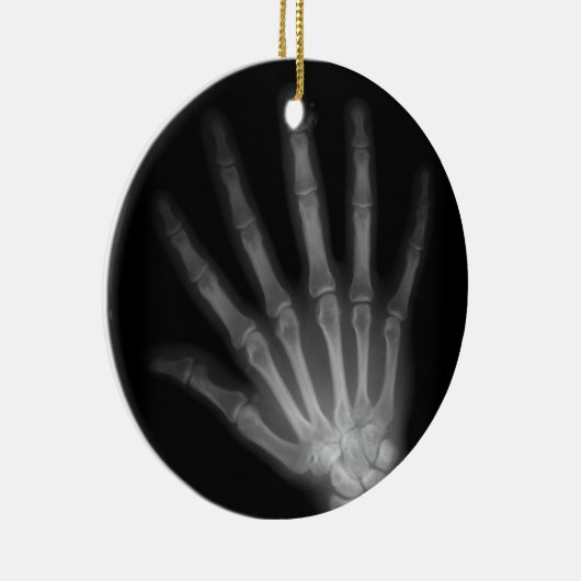 Extra Digit X-ray Right Hand Keramikornament (Rechts)