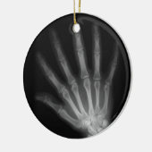 Extra Digit X-ray Right Hand Keramikornament (Links)