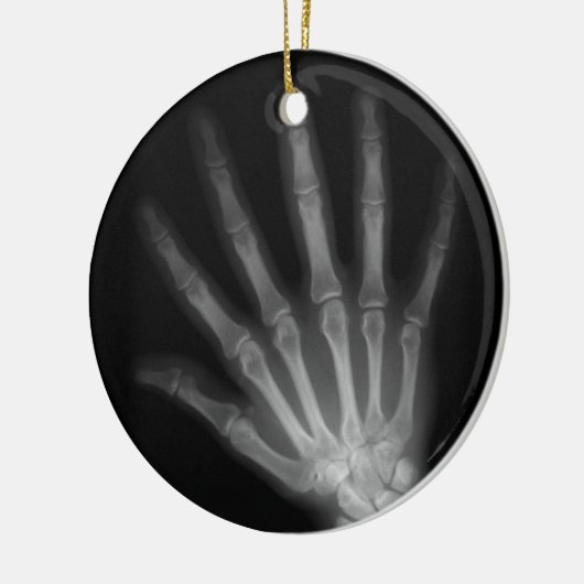 Extra Digit X-ray Right Hand Keramikornament (Links)