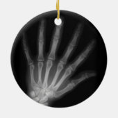 Extra Digit X-ray Right Hand Keramikornament (Hinten)