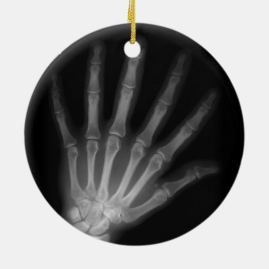 Extra Digit X-ray Right Hand Keramikornament (Hinten)