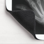 Extra Digit X-ray Right Hand Mousepad (Ecke)