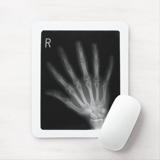 Extra Digit X-ray Right Hand Mousepad (Mit Mouse)