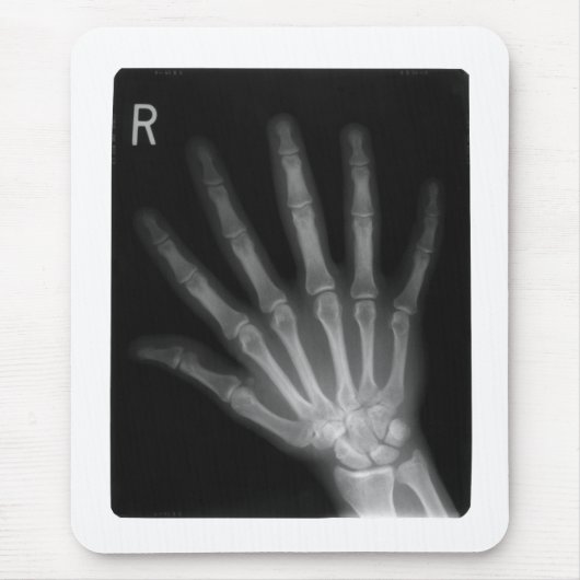 Extra Digit X-ray Right Hand Mousepad (Vorne)