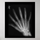Extra Digit X-ray Right Hand Poster (Vorne)