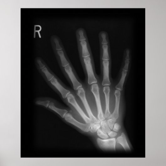 Extra Digit X-ray Right Hand Poster (Vorne)