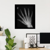 Extra Digit X-ray Right Hand Poster (Heimbüro)
