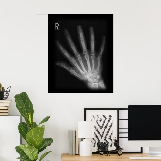 Extra Digit X-ray Right Hand Poster (Heimbüro)