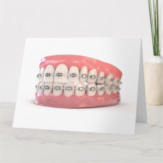 Fake zisst Set mit Brackets Karte