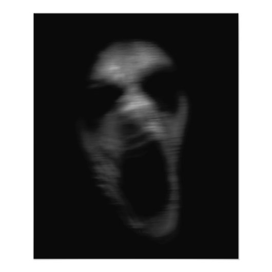 Fallende psychische Störungen Fotodruck (Vorne)