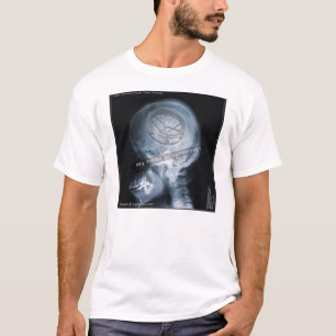 Fallstudie: Roto Tom Spieler T-Shirt