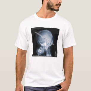 Fallstudie: Schlagzeuger T-Shirt