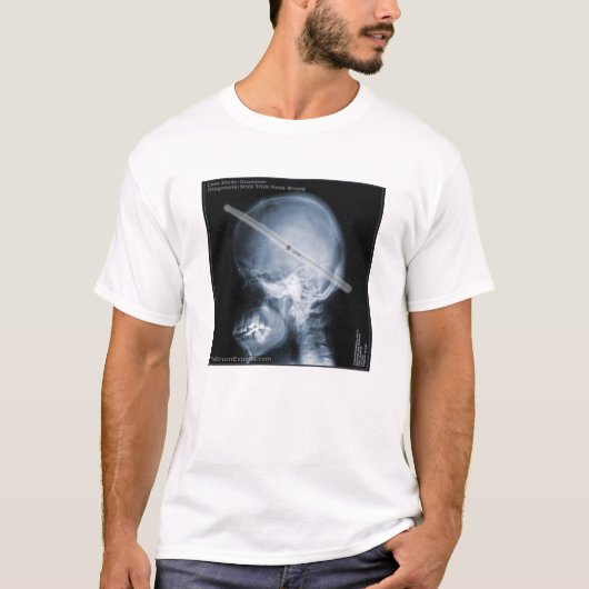 Fallstudie: Schlagzeuger T-Shirt (Vorderseite)
