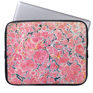 Farbige viktorianische Marmorpapierabdeckung Laptopschutzhülle