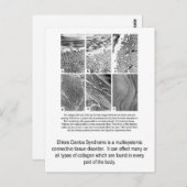 Fehlerhafte Kollagen EDS-Bewusstseins-Postkarte Postkarte (Vorne/Hinten)