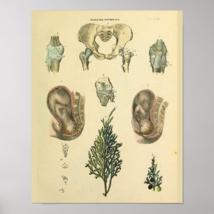 Fetale Position Becken Anatomie Vintage-Kunststoff Poster