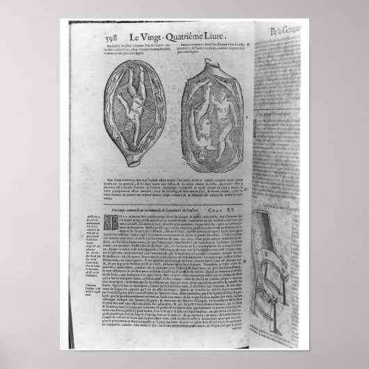 Fetus, Illustration von "Oeuvres" Poster (Vorne)